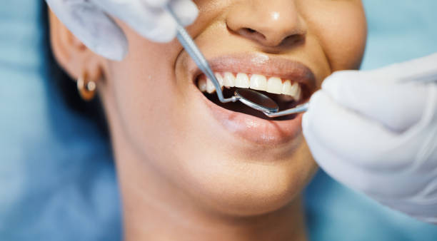 Best Emergency Treatment for Dental Infections or Abscesses in Lavonia, GA
