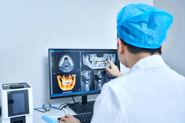 Best Emergency Treatment for Dental Infections or Abscesses in Lavonia, GA