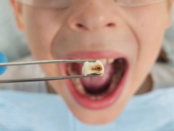 Best Emergency Gum Treatment in Lavonia, GA